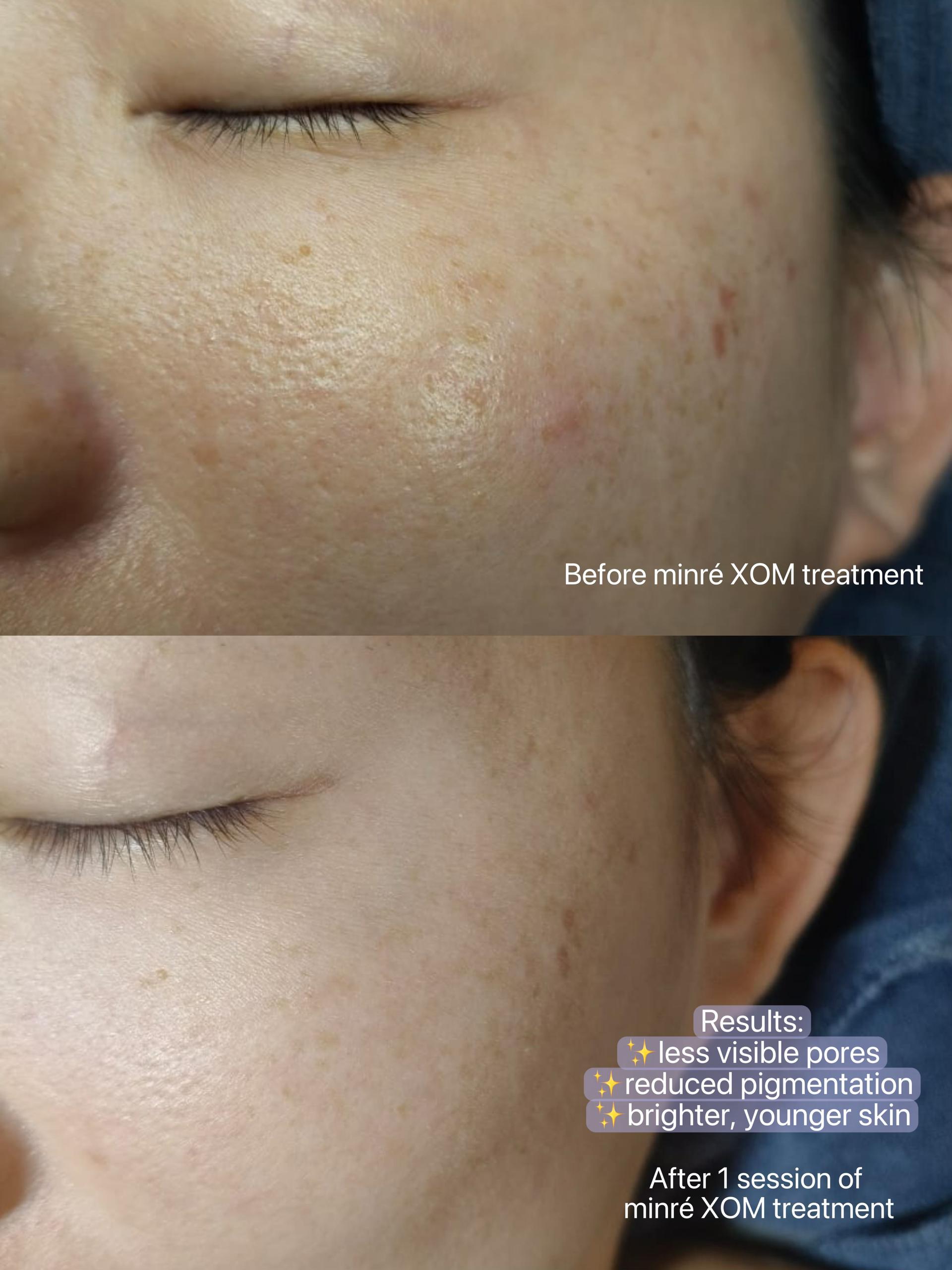 XOM Cellular Renewal Kit User 2