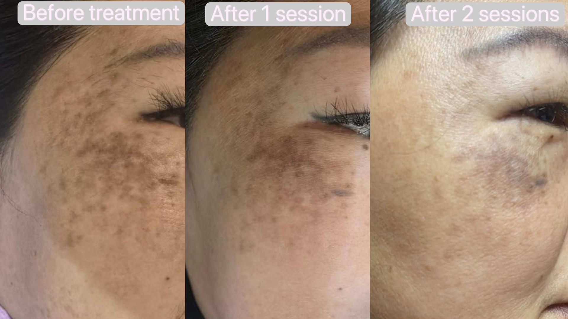 XOM Cellular Renewal Kit User 3