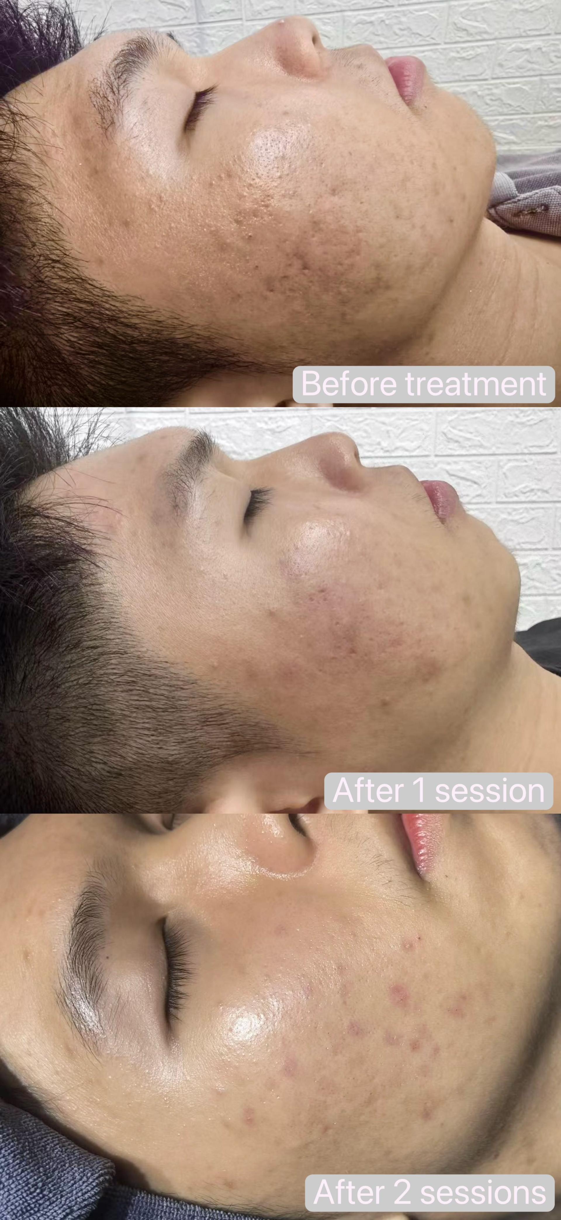 XOM Cellular Renewal Kit User 4