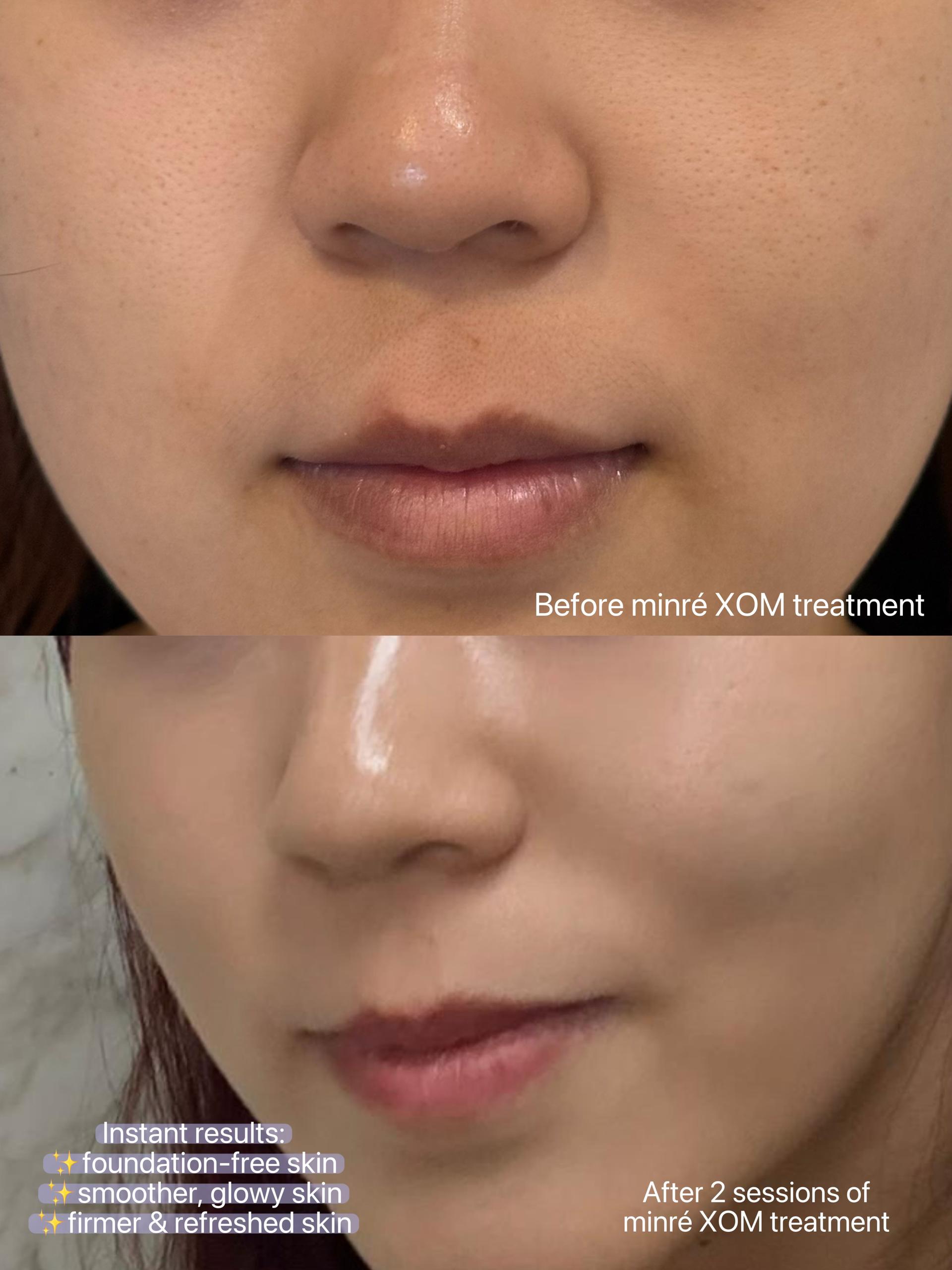 XOM Cellular Renewal Kit User