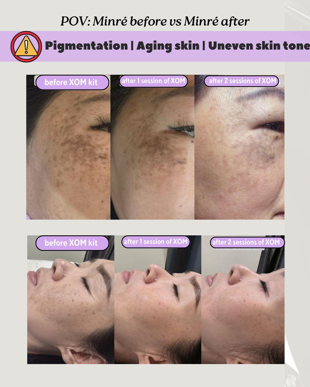 Before & After: Pigment