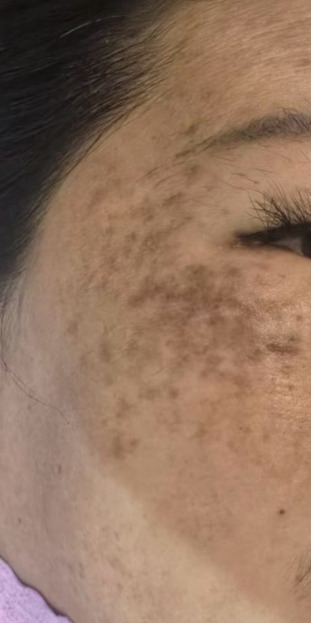 Before treatment - Case Study 1